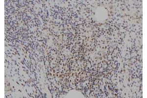 ABIN6273721 at 1/100 staining Human spleen tissue by IHC-P.