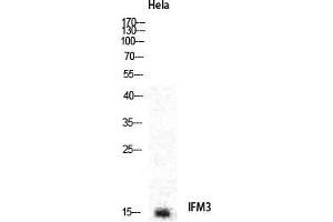 Western Blot (WB) analysis of specific cells using IFITM3 Polyclonal Antibody. (IFITM3 anticorps  (N-Term))