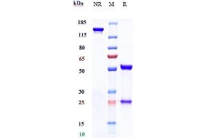 Anti-TROP2 Reference Antibody (sacituzumab) on SDS-PAGE under reducing (R) condition. (Recombinant Trop2 (Sacituzumab Biosimilar) anticorps)
