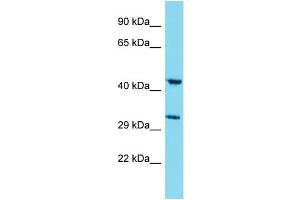 Western Blotting (WB) image for anti-Myb/SANT-Like DNA-Binding Domain Containing 4 with Coiled-Coils (MSANTD4) (N-Term) antibody (ABIN2791619) (MSANTD4 anticorps  (N-Term))