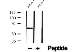 Western blot analysis of extracts of MCF-7 cells, using P4HA2 antibody. (P4HA2 anticorps  (Internal Region))