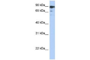 WB Suggested Anti-RBAK Antibody   Titration: 1. (RBAK anticorps  (Middle Region))