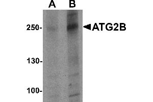 Western blot analysis of ATG2B in K562 cell lysate with ATG2B antibody at (A) 1 and (B) 2 µg/mL (ATG2B anticorps  (N-Term))