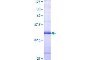Image no. 1 for Fyn-Related Kinase (FRK) (AA 391-505) protein (GST tag) (ABIN1354427)
