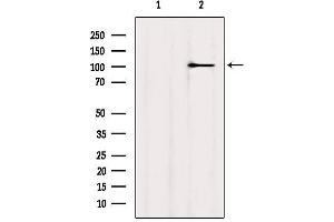 Western blot analysis of extracts from MCF7, using MYOCD Antibody.