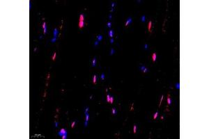 Immunofluorescence of paraffin embedded mouse Skeletal muscle using USP24 (ABIN7076111) at dilution of 1:650 (400x lens)