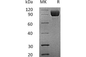 Western Blotting (WB) image for Interleukin 13 Receptor, alpha 1 (IL13RA1) protein (Fc Tag) (ABIN7320818)