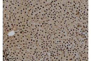 ABIN6263520 and ABIN6273271 at 1/100 staining Rat liver tissue by IHC-P.