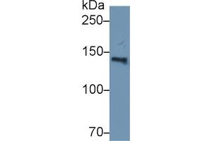 Western Blot; Sample: Human Serum; Primary Ab: 2µg/ml Rabbit Anti-Human HYOU1 Antibody Second Ab: 0.