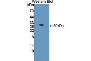 Western blot analysis of the recombinant protein. (ROCK1 anticorps  (AA 1094-1323))