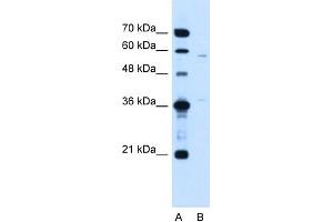 WB Suggested Anti-MGC39633 Antibody Titration:  1. (MGC39633 (N-Term) anticorps)