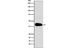 Western blot analysis of PAR6 expression in Jurkat cell lysate.