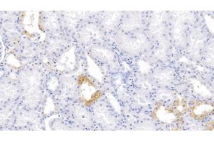 Detection of PBRM1 in Human Kidney Tissue using Polyclonal Antibody to Polybromo 1 (PBRM1)