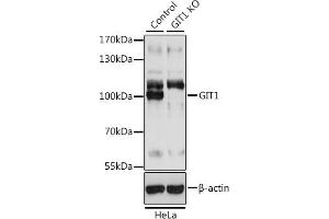 Western blot analysis of extracts from normal (control) and GIT1 knockout (KO) HeLa cells, using GIT1 antibody (ABIN7267383) at 1:3000 dilution. (GIT1 anticorps  (AA 460-640))