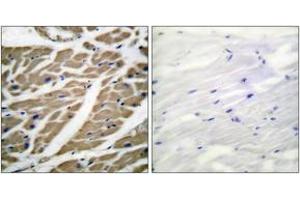 Immunohistochemistry analysis of paraffin-embedded human heart tissue, using Sodium Channel-pan Antibody. (Sodium Channel anticorps  (AA 1466-1515))