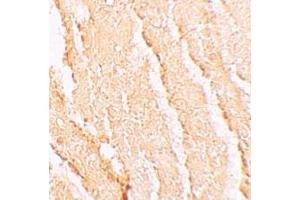 Immunohistochemistry (IHC) image for anti-Vacuolar Protein Sorting 39 Homolog (VPS39) (C-Term) antibody (ABIN1030796) (VPS39 anticorps  (C-Term))