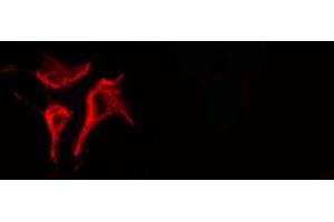 ABIN6266606 staining LOVO cells by IF/ICC.