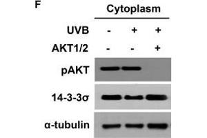 AKT cooperates with 14-3-3σ to facilitate nuclear translocation of TC45 in response to UVB irradiationWestern blot analysis of A.