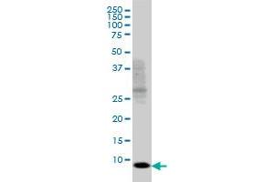 SH2D1A monoclonal antibody (M01), clone 1C9 Western Blot analysis of SH2D1A expression in Jurkat . (SH2D1A anticorps  (AA 1-128))