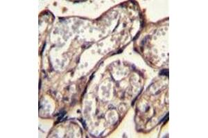 Formalin fixed and paraffin embedded human placenta tissue stained with IGF2 Antibody followed by peroxidase conjugation of the secondary antibody and DAB staining.