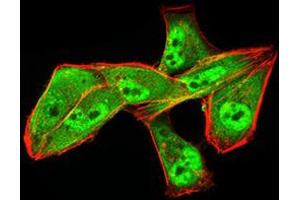 Immunocytochemistry (ICC) image for anti-Aldehyde Dehydrogenase 6 Family, Member A1 (ALDH6A1) (AA 1-195) antibody (ABIN5856297) (ALDH6A1 anticorps  (AA 1-195))