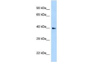 WB Suggested Anti-AIDA Antibody Titration: 1. (AIDA anticorps  (N-Term))