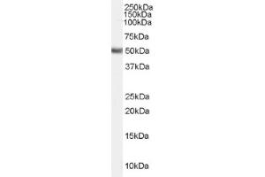 Image no. 1 for anti-Fatty Acid Desaturase 1 (FADS1) (Internal Region) antibody (ABIN374860) (FADS1 anticorps  (Internal Region))