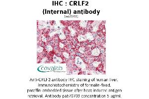 Image no. 2 for anti-Cytokine Receptor-Like Factor 2 (CRLF2) (Internal Region) antibody (ABIN1733318)