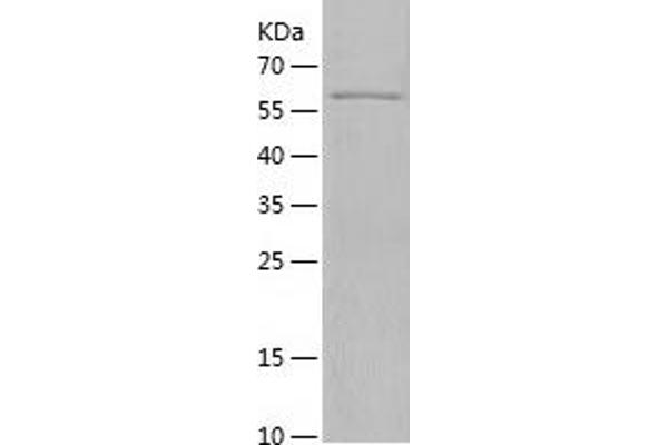 IGF2R Protein (AA 2159-2491) (His-IF2DI Tag)
