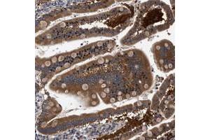 Immunohistochemical staining of human duodenum with FAM185A polyclonal antibody  strong cytoplasmic positivity in glandular cells at 1:50-1:200 dilution. (FAM185A anticorps)