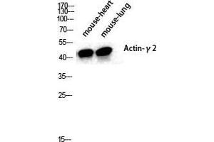 Western Blot (WB) analysis of specific cells using Actin alpha3 Polyclonal Antibody. (Actin Alpha3 (N-Term) anticorps)