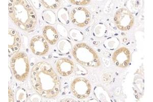 Detection of CLDN1 in Human Kidney Tissue using Polyclonal Antibody to Claudin 1 (CLDN1)