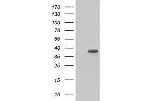 Western Blotting (WB) image for anti-3-hydroxyisobutyryl-CoA Hydrolase (HIBCH) antibody (ABIN1498655)