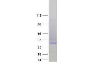 Validation with Western Blot