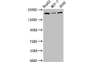 Western Blot Positive WB detected in: HepG2 whole cell lysate, MCF-7 whole cell lysate, A549 whole cell lysate, All lanes: OBSL1 antibody at 2. (Obscurin-Like 1 (OBSL1) (AA 1-61) anticorps)