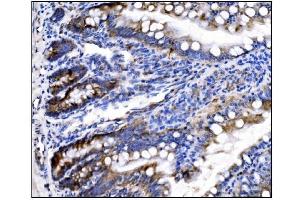 IHC analysis of HCCS using anti-HCCS antibody (ABIN7602424). (HCCS anticorps  (AA 76-268))