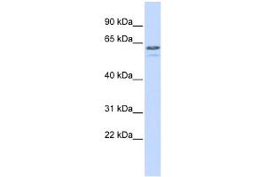 WB Suggested Anti-TRIM6 Antibody Titration:  0. (TRIM6 anticorps  (N-Term))