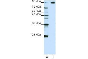 SF3B1 antibody used at 1. (SF3B1 anticorps  (Middle Region))