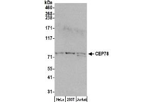 Western Blotting (WB) image for anti-Centrosomal Protein 78kDa (CEP78) (AA 639-689) antibody (ABIN7451697)