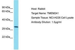 Image no. 1 for anti-Transmembrane Protein 241 (TMEM241) (AA 151-200) antibody (ABIN6750715) (TMEM241 anticorps  (AA 151-200))