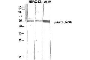 Western Blotting (WB) image for anti-V-Akt Murine Thymoma Viral Oncogene Homolog 1 (AKT1) (pThr450) antibody (ABIN3172849) (AKT1 anticorps  (pThr450))