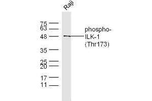 Raji cell lysates probed with Rabbit Anti-ILK-1(Thr173) Polyclonal Antibody, Unconjugated  at 1:500 for 90 min at 37˚C.