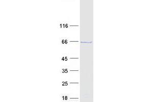Validation with Western Blot