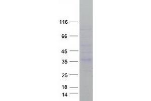 Validation with Western Blot