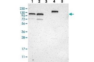 Western blot analysis of Lane 1: RT-4, Lane 2: U-251 MG, Lane 3: Human Plasma, Lane 4: Liver, Lane 5: Tonsil with ZBTB11 polyclonal antibody  at 1:250-1:500 dilution. (ZBTB11 anticorps)