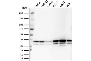 Western Blot Analysis of HeLa, HepG2, Jurkat, HEP2, U937, PC3 cell lysates using MDH1 Mouse Monoclonal Antibody (CPTC-MDH1-1). (MDH1 anticorps)