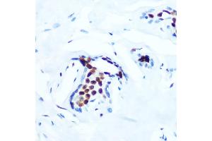Immunohistochemistry of paraffin-embedded human breast using Phospho-c-Jun-T91 Rabbit mAb (ABIN7268057) at dilution of 1:100 (40x lens).