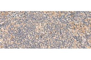 Immunohistochemistry of paraffin-embedded Human tonsil tissue using FUNDC2 Polyclonal Antibody at dilution of 1:50(x200) (FUNDC2 anticorps)