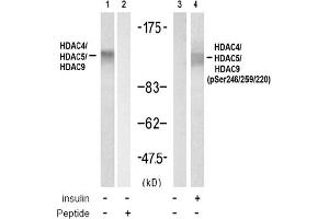 Image no. 1 for anti-HDAC4,HDAC5,HDAC9 (pSer220), (pSer246), (pSer259) antibody (ABIN319279) (HDAC4/HDAC5/HDAC9 anticorps  (pSer220, pSer246, pSer259))