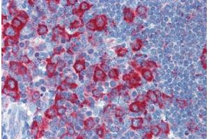 anti-Protein Kinase, Interferon-Inducible Double Stranded RNA Dependent Activator (PRKRA) (N-Term) antibody